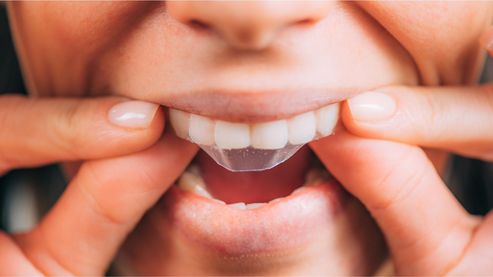 Are Teeth Whitening Strips Wholesale Effective?